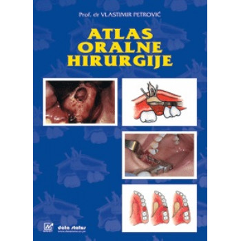 ATLAS ORALNE HIRURGIJE 