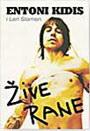 ŽIVE RANE 