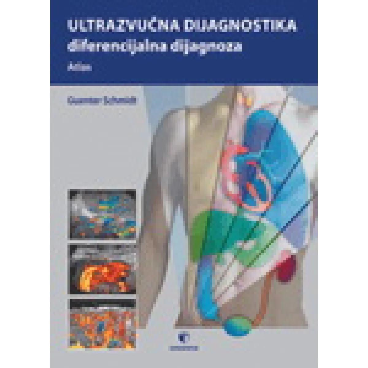 ULTRAZVUČNA DIJAGNOSTIKA 